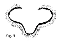 AltName