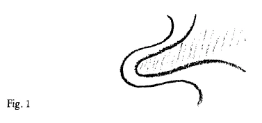 AltName